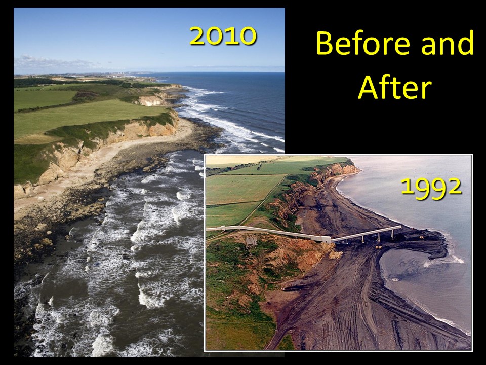 Before and After of Easington Colliery beach banks from 1992 to 2010